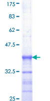 12.5% SDS-PAGE Stained with Coomassie Blue.